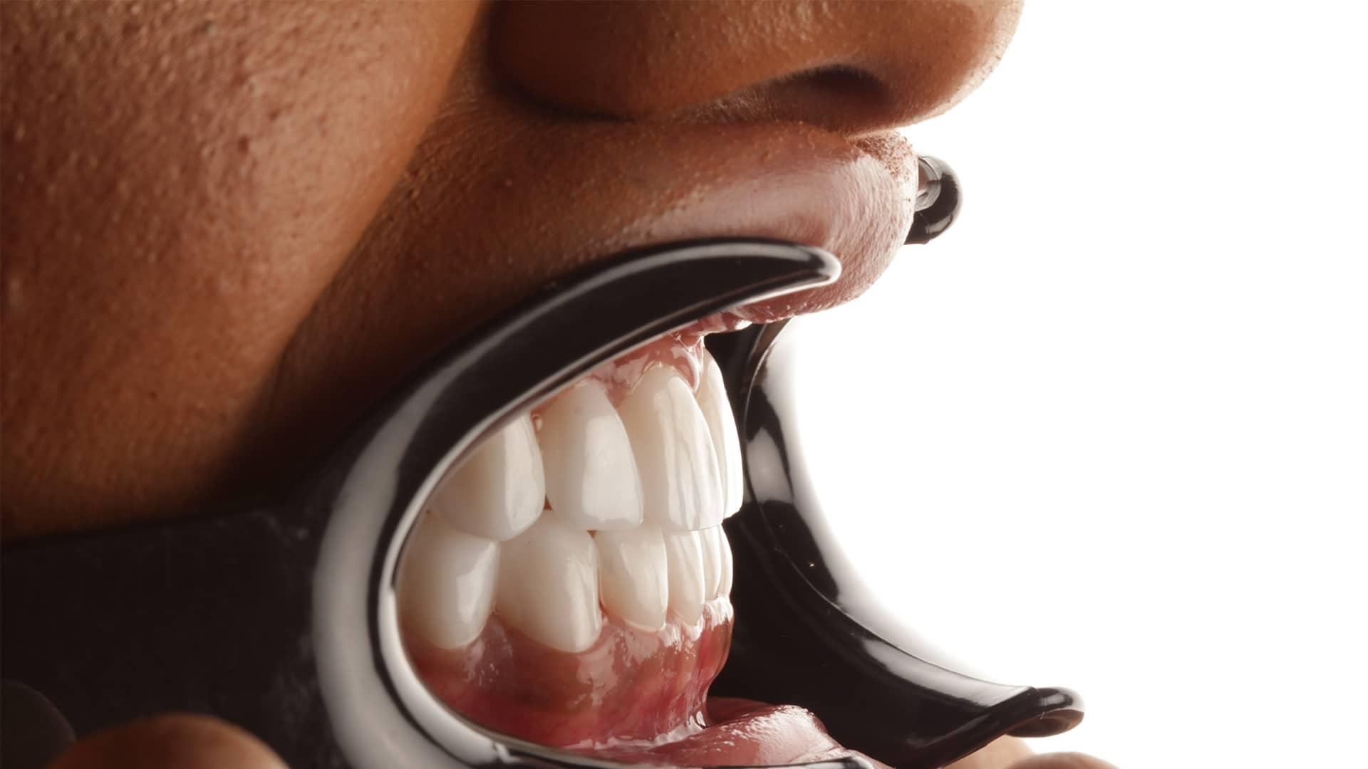 Zirconium Porcelain Crowns